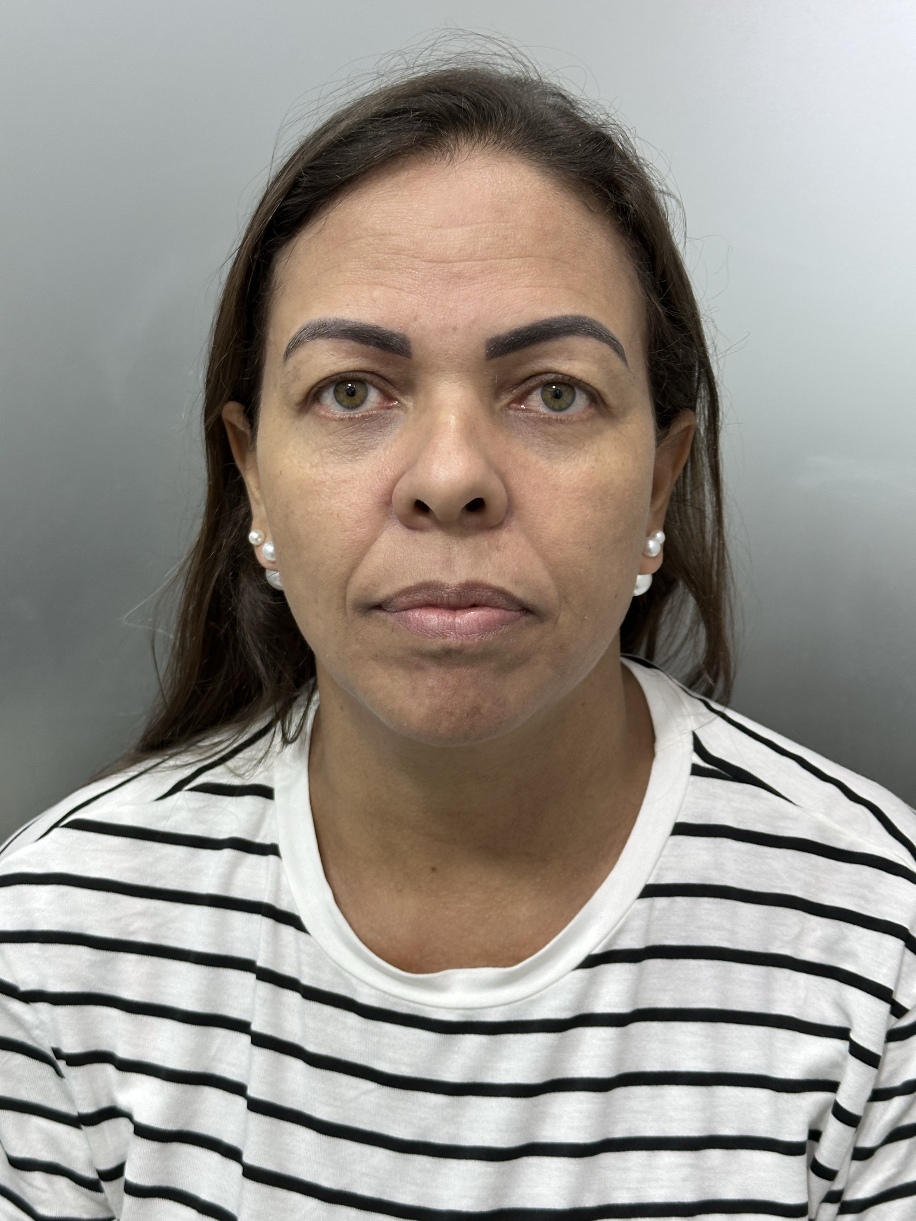 Antes da blefaroplastia superior inferior e castanhares em Belo Horizonte